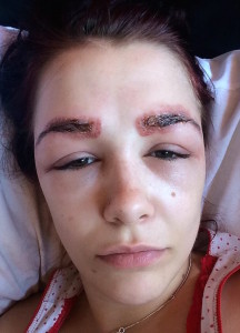 2ADFEB1A00000578-3175932-Polly_Smith_suffered_a_severe_allergic_reaction_leaving_her_with-a-32_14379987731741
